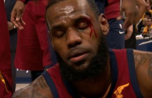 LeBron James Bleeding After Taking Elbow to Face